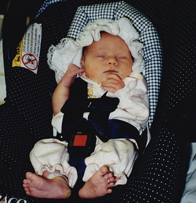 PKU patient as a baby.